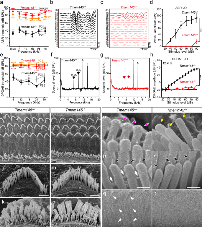Fig. 2: TMEM145 is essential for auditory function and the structural integrity of TM-ACs and HTCs in OHC stereocilia.
