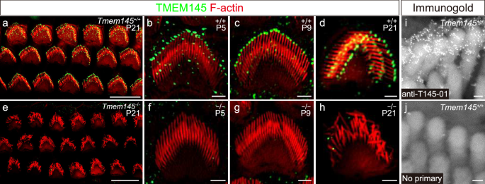 Fig. 3: TMEM145 expression in OHC stereocilia and its association with TM-ACs and HTCs.