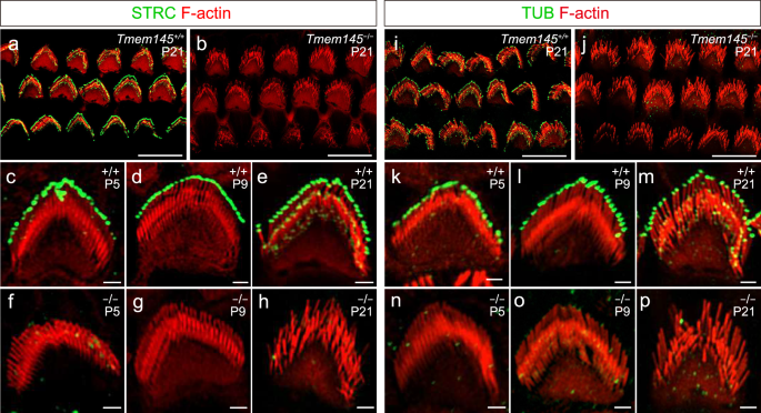 Fig. 5: Mislocalized STRC and TUB in Tmem145−/− OHC stereocilia.