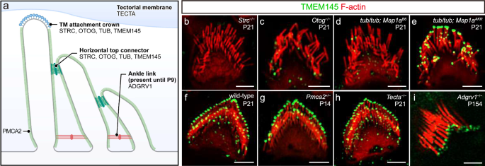 Fig. 6: Localization of TMEM145 is only affected in TM-AC and HTC components.