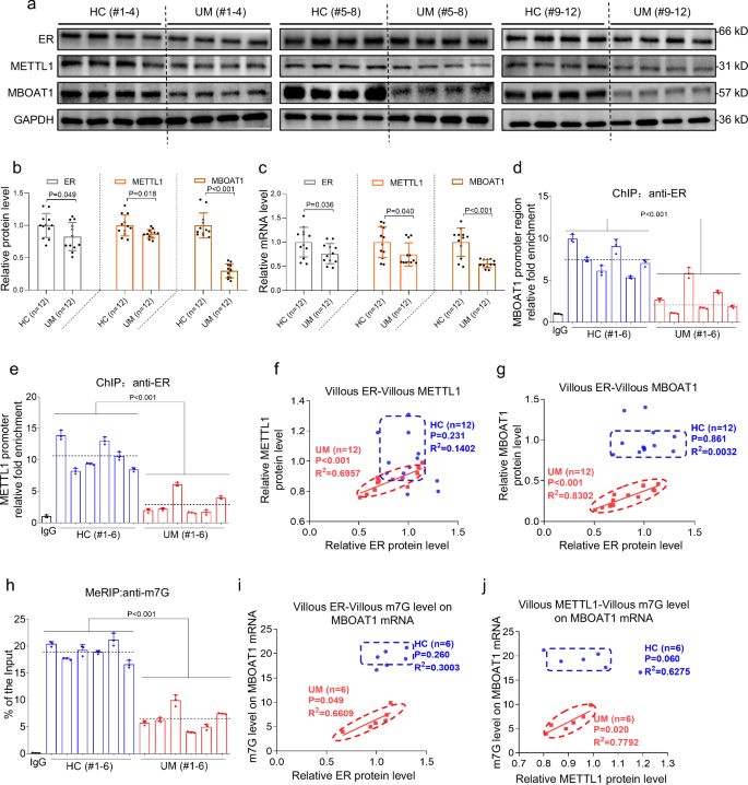 can glutathione cause miscarriage Lithium exposure causes ferroptosis to induce unexplained miscarriage  through non-canonical MBOAT1 pathway