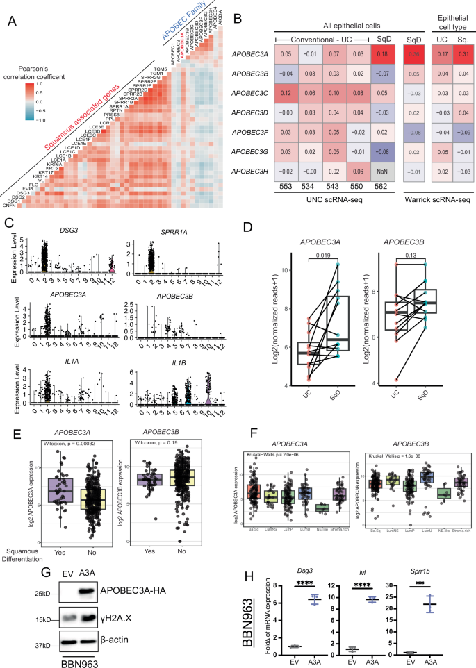 Fig. 6: Human A3A, but not A3B, is associated with squamous differentiation.