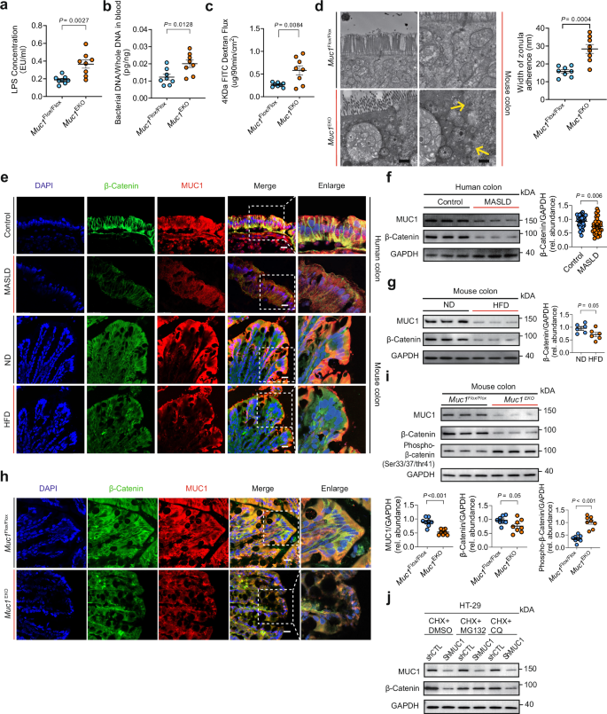 Fig. 4: Enterocytic MUC1 influences the progression of MASLD via modulation of β-catenin.