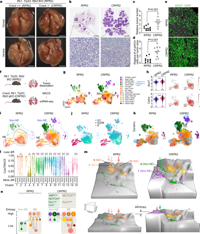 Fig. 1: Transformation of preneoplastic SCLC cells into SCLC-like cells by CRACD depletion.