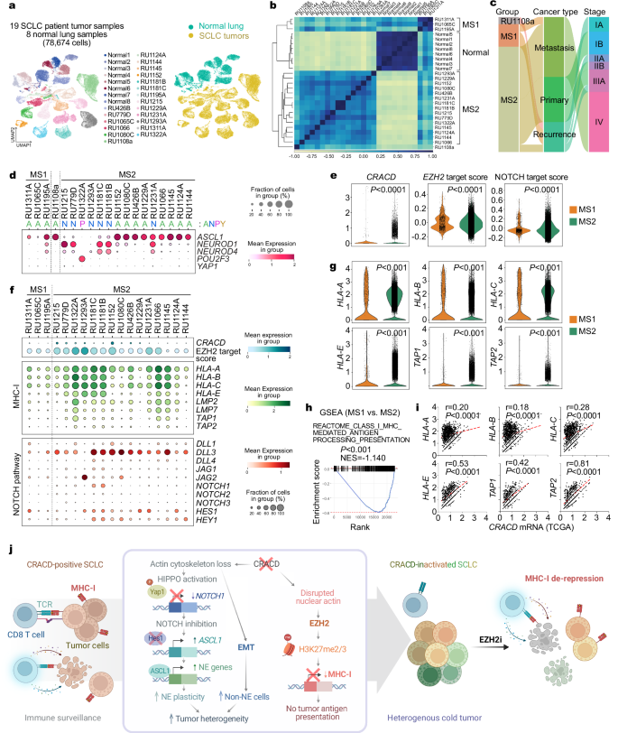 Fig. 5: Pathological relevance of the CRACD-EZH2-MHC-I axis in SCLC.