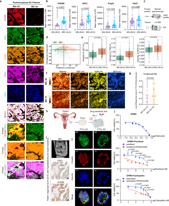 Fig. 7: OA-HOXB9/Praja2-ODC1/OAZ1 axis exists in ECWMS.