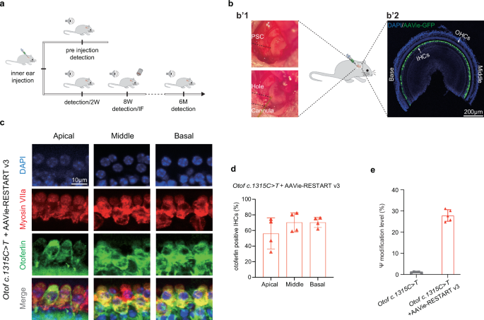 Fig. 4: AAV-RESTART v3 rescues otoferlin expression in the Otof c.1315 C > T (p.R439*) mice.