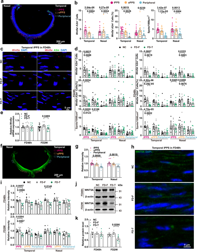 Fig. 3: Scleral Wnt5a+ cluster alteration in FDM mice using RNAscope, and scleral WNT5A protein level change in FDM mice by immunofluorescence and western blot.