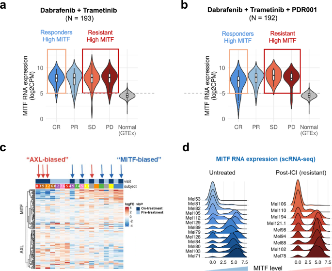Fig. 1: MITF expression in melanoma patients treated with targeted and immunotherapy.
