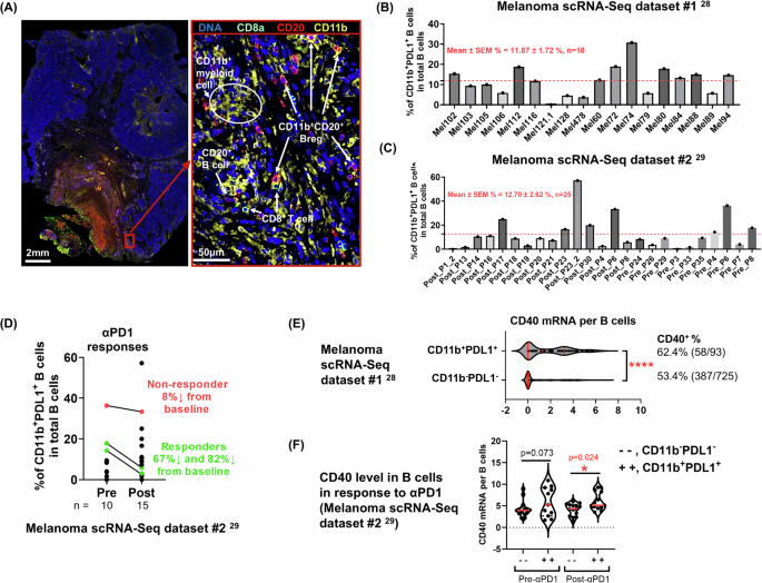 Fig. 1: CD11b+ regulatory B cells in patient melanoma tumors.