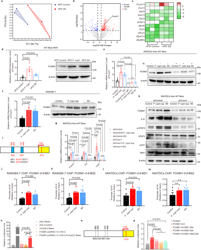 Fig. 6: FOXM1 is an important transcription factor that positively regulates Il-6 expression.
