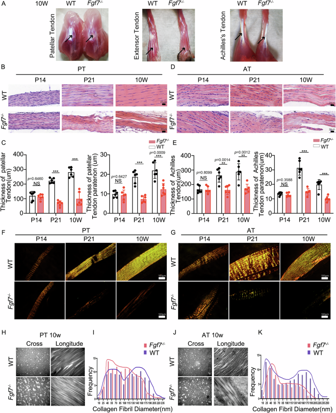 Fig. 2: Macro-, micro-, and nano-structural abnormalities in load-bearing tendons of Fgf7−/− mice.