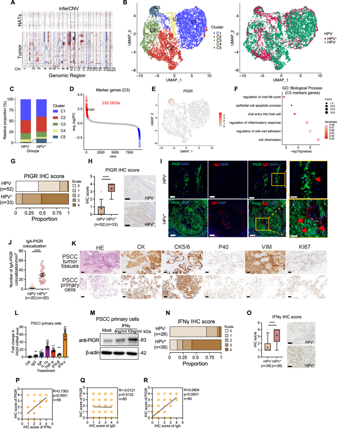 Fig. 4: PIGR+ epithelial cells are enriched in HPV+ PSCC and are induced by IFNγ.