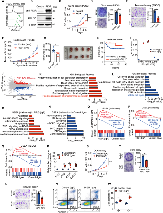 Fig. 5: PIGR-mediated IgA transcytosis promotes anti-tumor activity in PSCC primary cells.