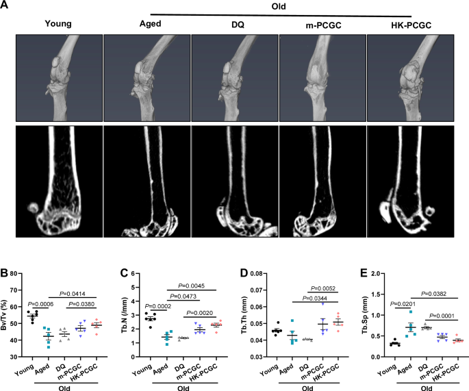 Fig. 8: The nanosenolytic therapy on bone microstructure changes.