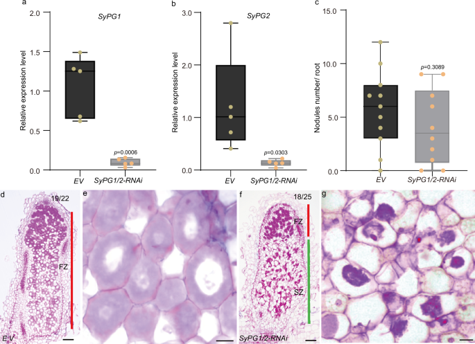 Fig. 3: The senescence zone is significantly enlarged in SyPG1/2-RNAi nodule.