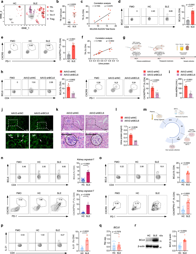 Fig. 1: MCs lead to aberrant differentiation of Tfh cells in human LN.