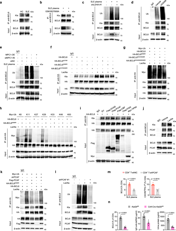 Fig. 6: Lactylation at Lys688 regulated by PCAF orchestrates the remodeling of BCL6 ubiquitination.