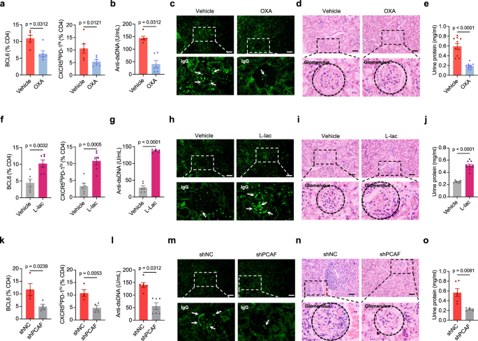 Fig. 7: Targeting lactate and BCL6 lactylation effectively alleviates LN disease.