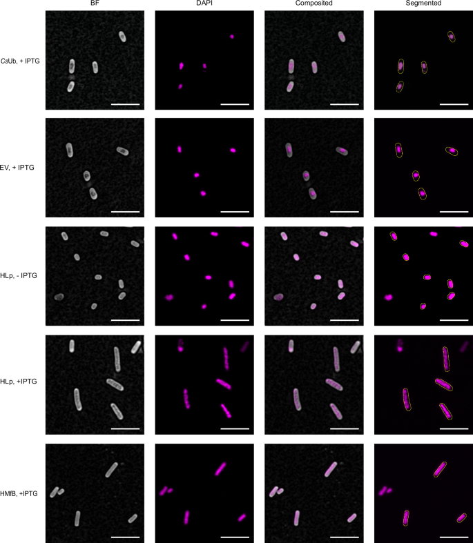 Fig. 7: HLp binds to genomic DNA in vivo.