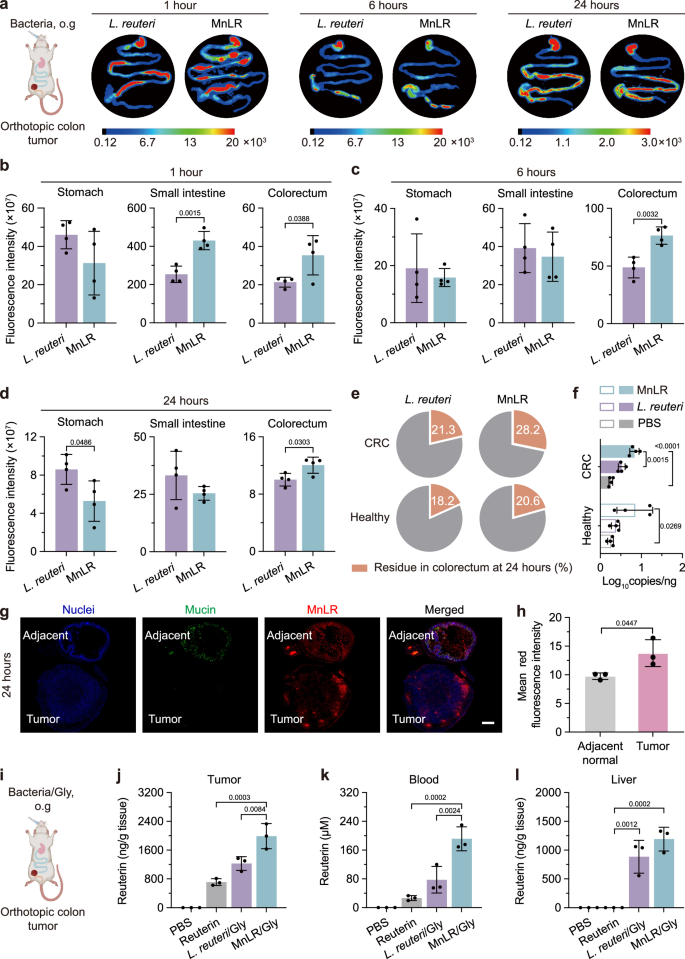 Fig. 5: Dynamic distribution of oral MnLR and L. reuteri within the GI tract.