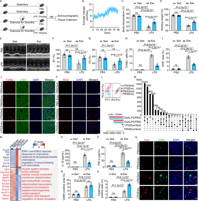 Fig. 1: Regular physical exercise safeguards cardiac function against SICM by modulating the cardiac immune microenvironment.