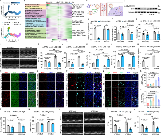 Fig. 4: Regular exercise induces a monocyte-derived iNOS+ subset to protect septic cardiac function.