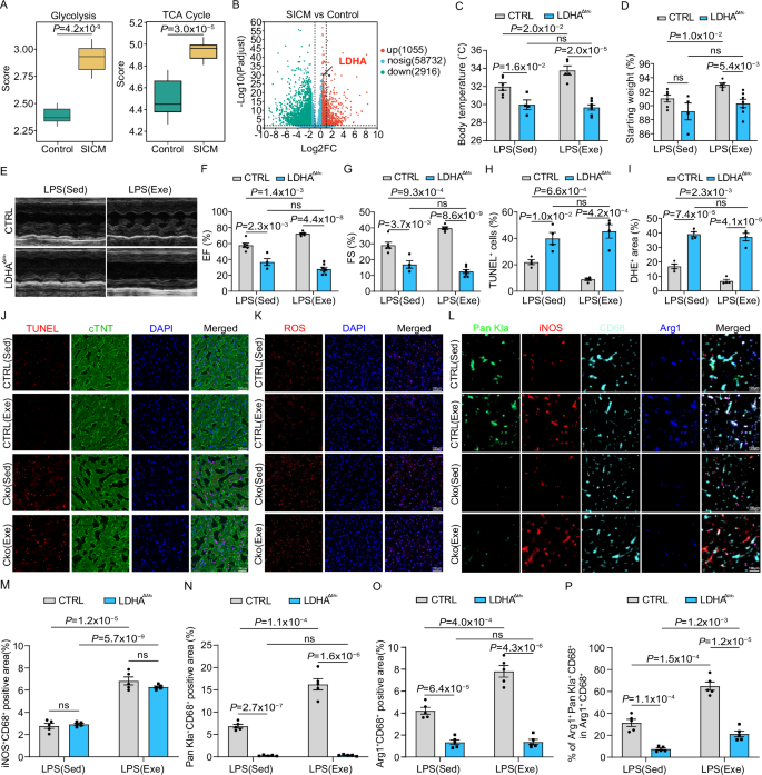 Fig. 6: Voluntary running induces histone lactylation in monocyte-derived macrophages to protect cardiac function in SICM.
