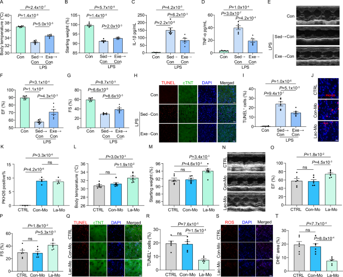 Fig. 9: Lactate-educated monocyte transfusion improves cardiac function in SICM.