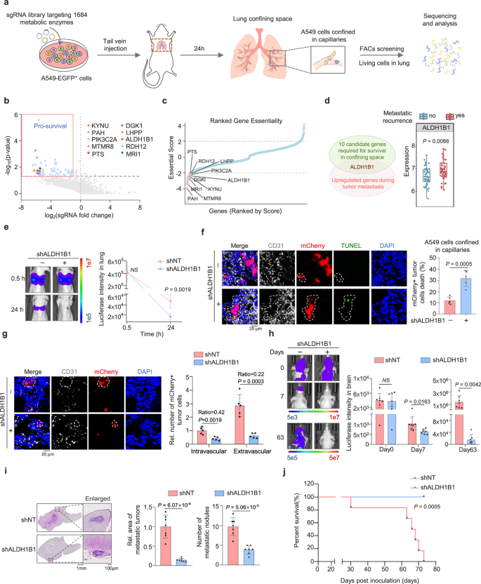 Fig. 1: ALDH1B1 is required for tumor cell survival in confining space and distant metastasis.