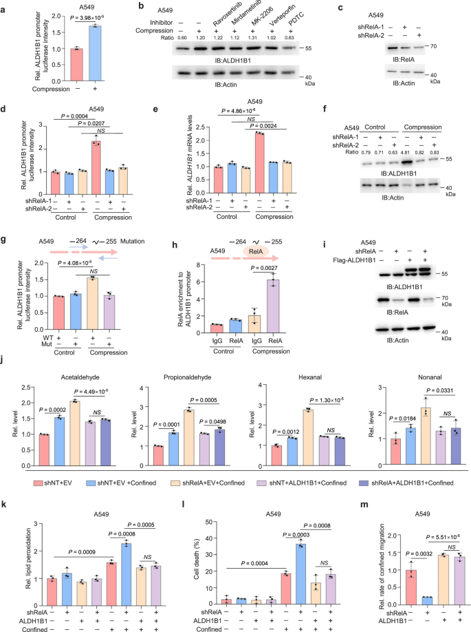 Fig. 4: NF-κB upregulates ALDH1B1 expression upon compression.