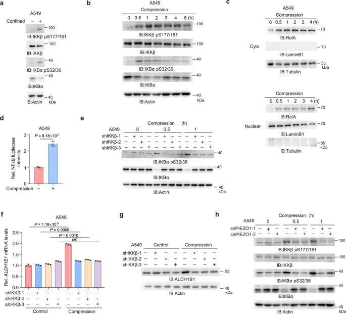 Fig. 5: Compressive force activates IKKβ and NF-κB via PIEZO1.