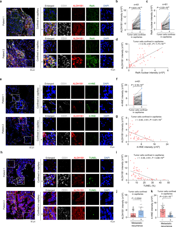 Fig. 7: Clinical relevance of NF-κB-dependent ALDH1B1 expression in lung cancer patients.