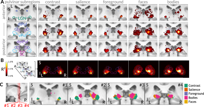 Fig. 2: Distinct regions of the pulvinar responsive to low- and high-level visual features.