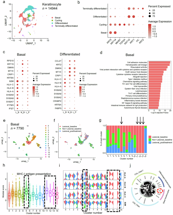 Fig. 5: Normalization of transcriptomic dysregulation in keratinocytes following anti–IL-23 treatment.