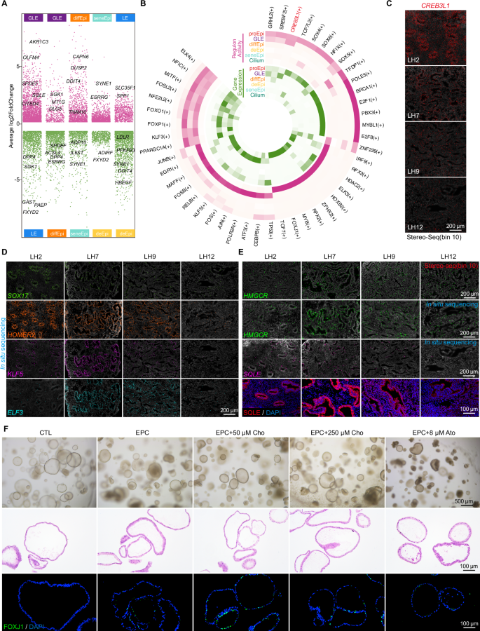 Fig. 5: Epithelial cholesterol metabolism in ciliogenesis.