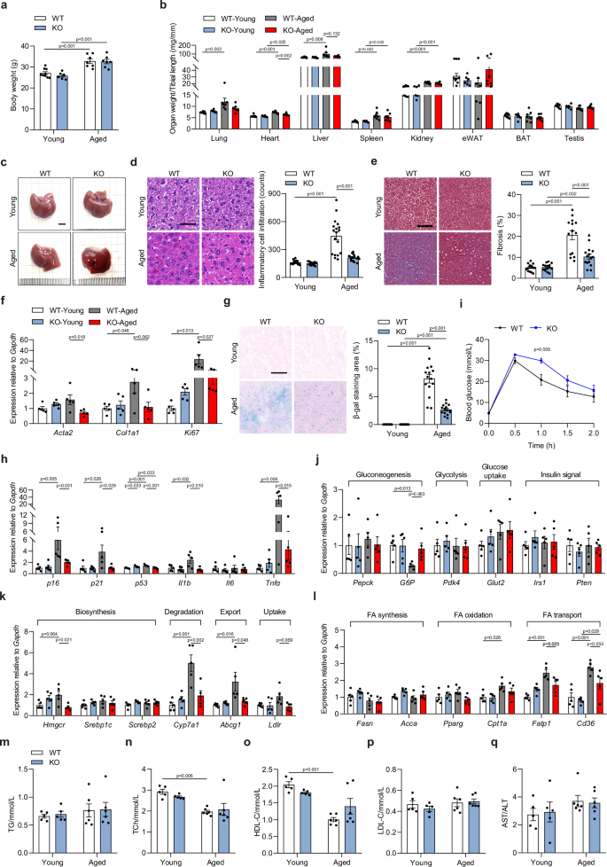 Fig. 2: Deletion of Armh4 decelerates the senescence and metabolic dysfunction in the liver.