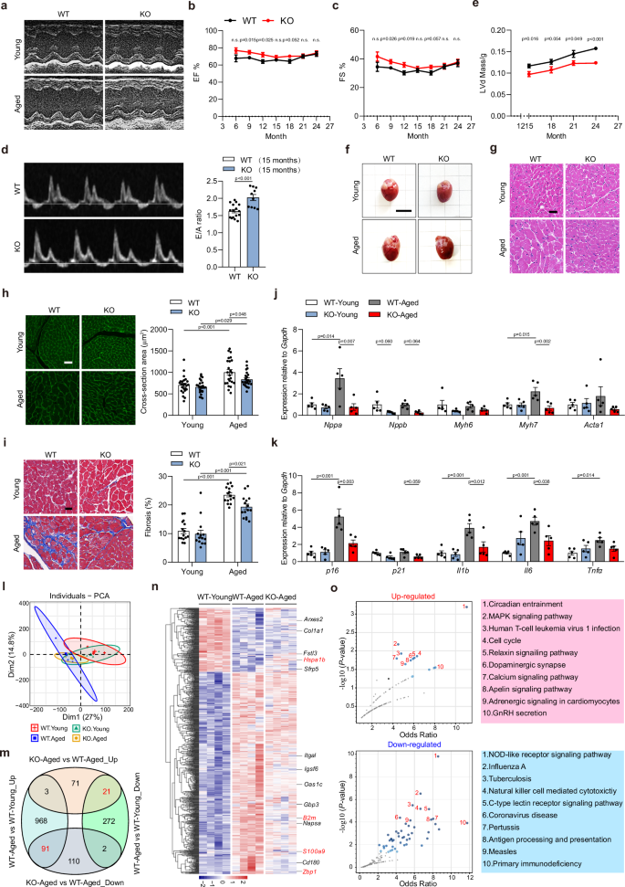 Fig. 3: Armh4 deficiency decelerates cardiac aging.