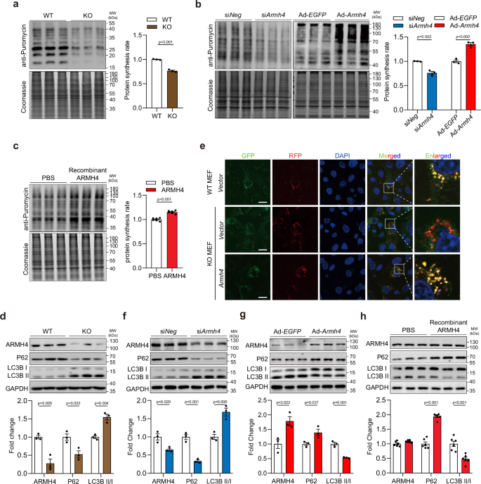 Fig. 5: Armh4 deletion suppresses protein synthesis and enhances autophagy.