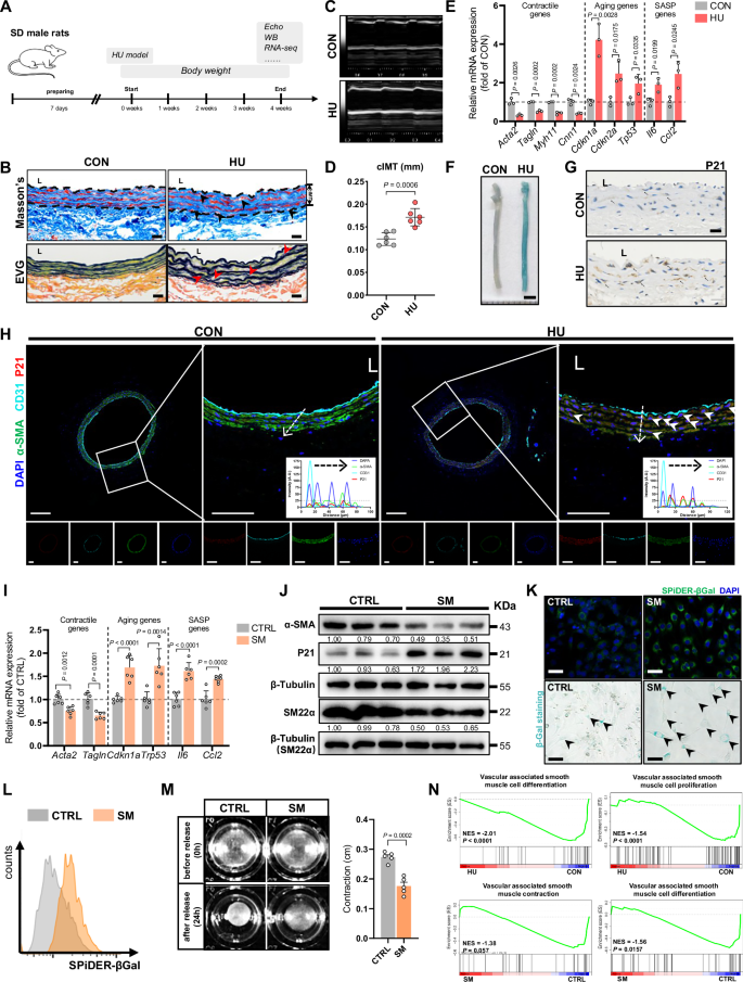 Fig. 1: Simulated microgravity leads to senescence-like remodeling of VSMC in the carotid artery.