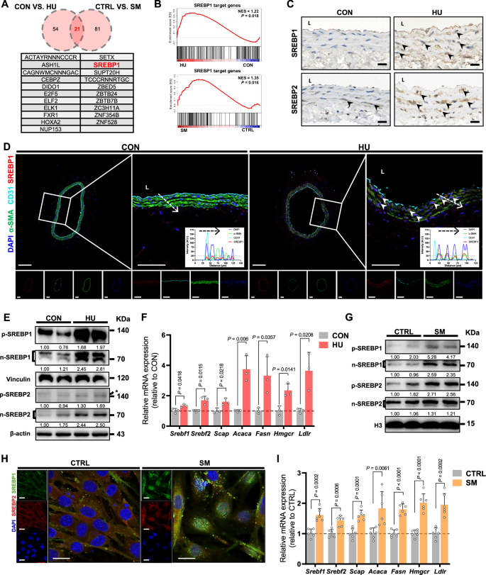 Fig. 3: SREBPs-mediated lipogenesis are activated by simulated microgravity.