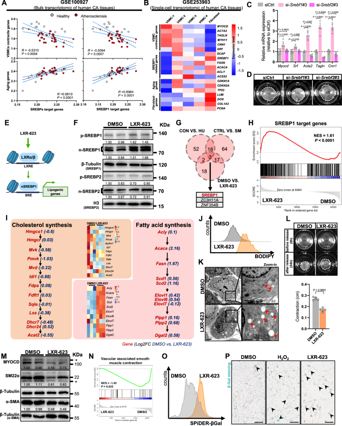 Fig. 4: SREBP1 directly promotes the senescence-like transformation of VSMC by activating lipogenesis.
