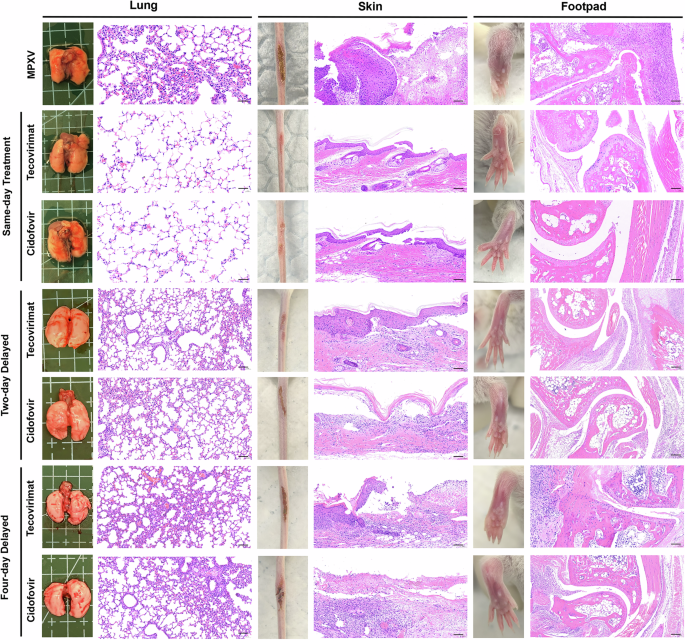 Fig. 5: Clinical symptoms and histopathology sections of the lung, skin, and footpad.