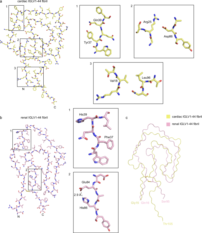 Fig. 4: Comparison of the cryo-EM structures of cardiac IGLV1-44 fibril and renal IGLV1-44 fibril.