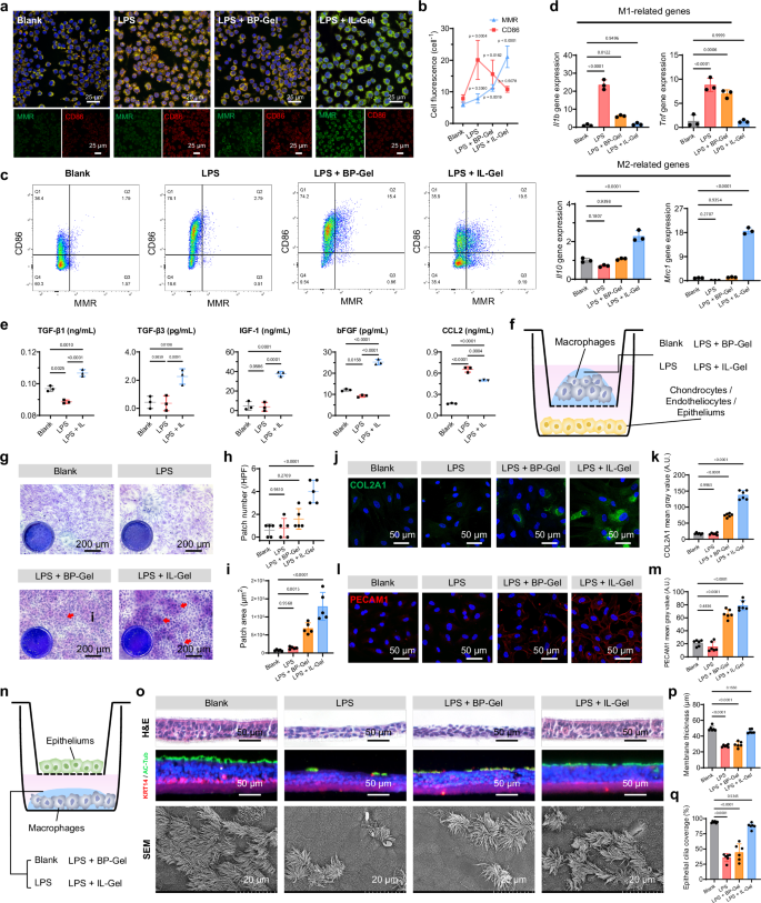 Fig. 3: Effects of IL-Gel on macrophage polarization and subsequent effects of polarized macrophages on chondrocytes, endothelial cells, and epithelial cells.