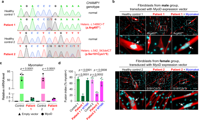 Fig. 3: CHAMP1 patient cells show reduced MYMK expression and defective myoblast fusion which can be rescued by Myomaker overexpression.