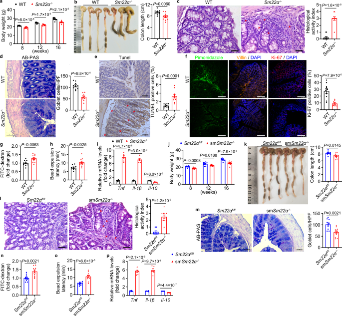 Fig. 1: SM22α deficiency induces spontaneous colitis.