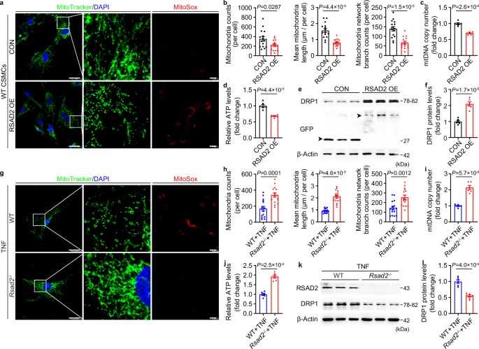 Fig. 5: RSAD2 promotes DRP1 expression and mitochondrial fragmentation.