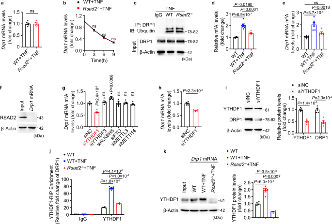 Fig. 6: RSAD2 promotes Drp1 mRNA translation by facilitating the activity of the m6A reader YTHDF1.