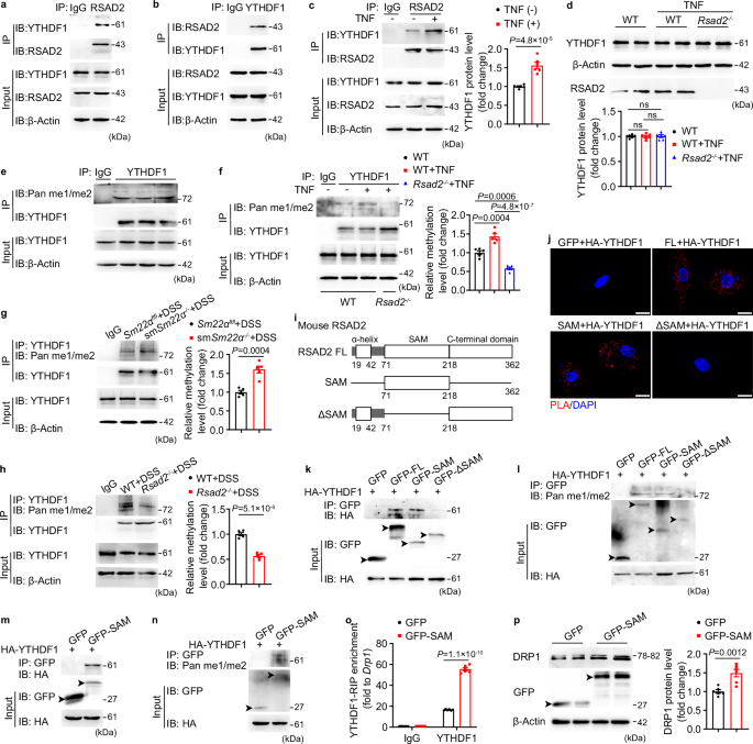 Fig. 7: RSAD2 induces DRP1 protein expression through methylating YTHDF1.